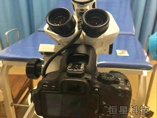 光电一体化阴道镜(进口徕卡光学镜头) 光电一体化阴道镜(进口徕卡光学镜头)