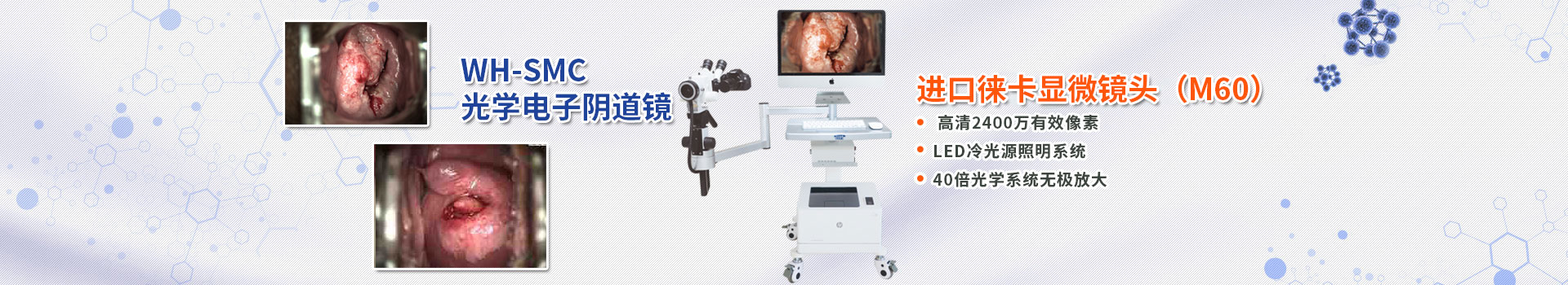 光学电子阴道镜-电子阴道镜-湖南恒星科技股份有限公司