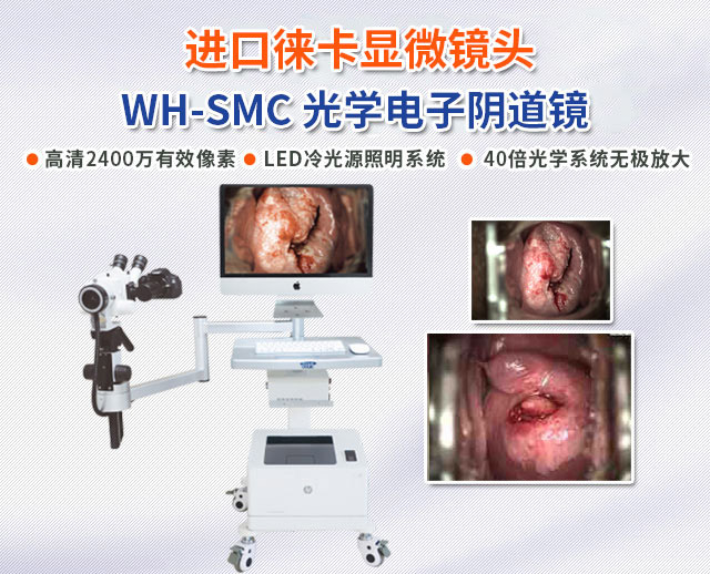 光学电子阴道镜—电子阴道镜—湖南恒星科技股份有限公司