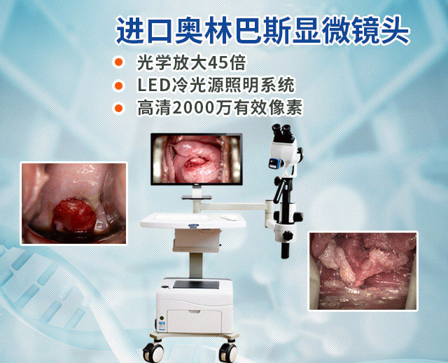 光学电子阴道镜—电子阴道镜—湖南恒星科技股份有限公司